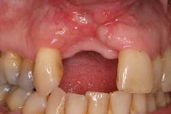 15srrfeb26froumsocketbone02a 15srrfeb26froumsocketbone02a