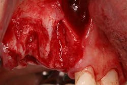 15srrfeb26froumsocketbone03a 15srrfeb26froumsocketbone03a