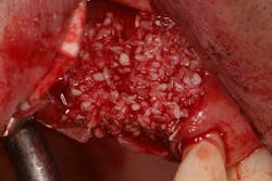 15srrfeb26froumsocketbone03b 15srrfeb26froumsocketbone03b