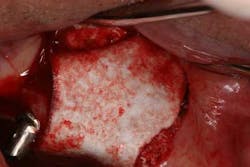 15srrfeb26froumsocketbone03b1 15srrfeb26froumsocketbone03b1