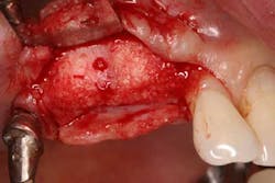 15srrfeb26froumsocketbone03c 15srrfeb26froumsocketbone03c