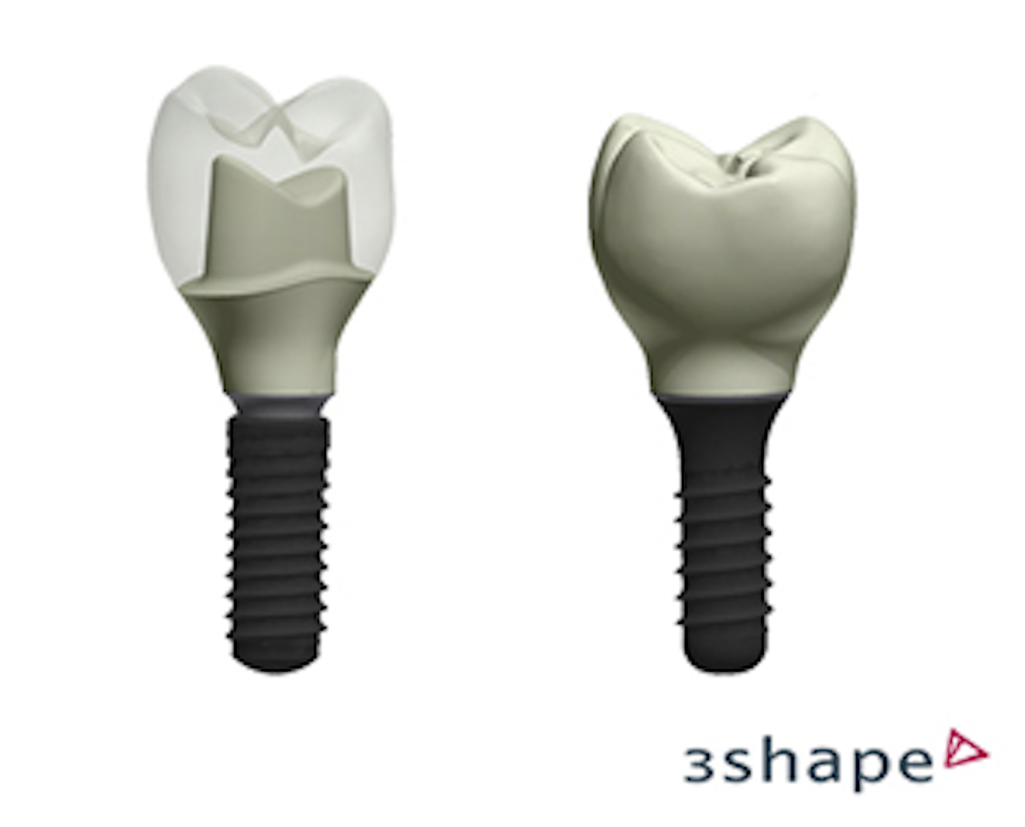 3Shape's Dental System offers CAD design for Straumann Customized
