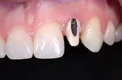 Accessopening01 Accessopening01