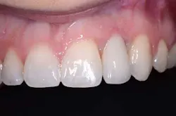 Accessopening02 Accessopening02