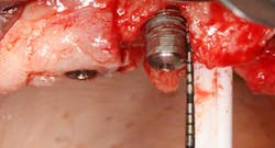 Apr112013 Froum Fig1 Apr112013 Froum Fig1