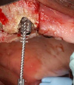 Apr112013 Froum Fig3 Apr112013 Froum Fig3