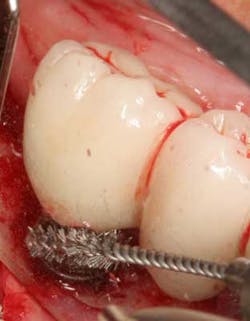 Apr112013 Froum Fig5 Apr112013 Froum Fig5