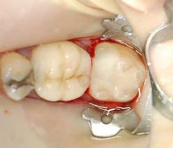 Apr112013 Gottlieb Fig4 Apr112013 Gottlieb Fig4