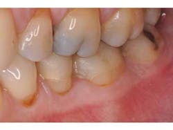 Bondcompsalierno1 Bondcompsalierno1