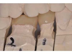 Bondcompsalierno2 Bondcompsalierno2