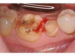 Bondcompsalierno4 Bondcompsalierno4