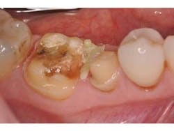 Bondcompsalierno5 Bondcompsalierno5