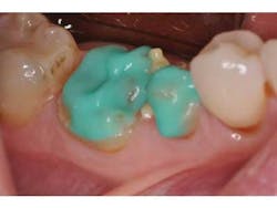 Bondcompsalierno6 Bondcompsalierno6