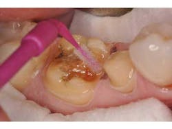 Bondcompsalierno7 Bondcompsalierno7