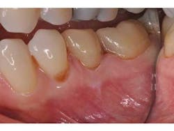 Bondcompsalierno8 Bondcompsalierno8