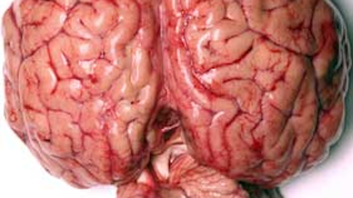 Brain Dreamstime