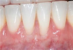 Doobrowfig5 Doobrowfig5