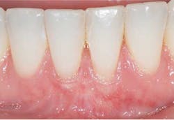 Doobrowfig6 Doobrowfig6