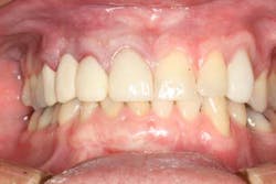 Fig1 froum cohen aug2012 Fig1 froum cohen aug2012