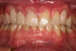 Fig10 froum cohen aug2012 Fig10 froum cohen aug2012