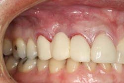 Fig2 froum cohen aug2012 Fig2 froum cohen aug2012