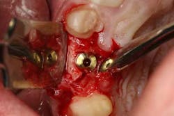 Fig4 froum cohen aug2012 Fig4 froum cohen aug2012