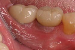 Florezjuly2013fig3a Florezjuly2013fig3a