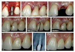 Joicasestudy2april302014 Joicasestudy2april302014