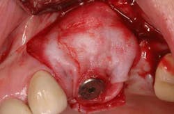 June2012froum03b June2012froum03b