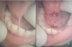 Koblercase2 Koblercase2