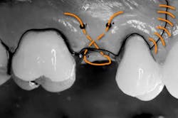 Mar142013srrgeminianifig6 Mar142013srrgeminianifig6