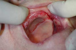 Mar142013srrtrochessetfig2 Mar142013srrtrochessetfig2