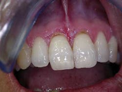 Mar142013srrtrochessetfig3 Mar142013srrtrochessetfig3