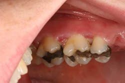 Mar142013srrtrochessetfig4 Mar142013srrtrochessetfig4