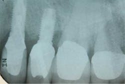 Oct2012froumfig2a Oct2012froumfig2a