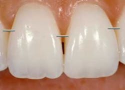 Openembrasure Openembrasure