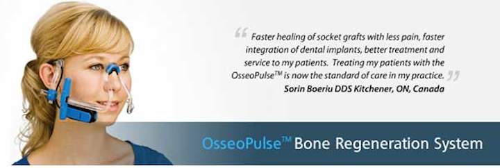 Osseopulsebrs