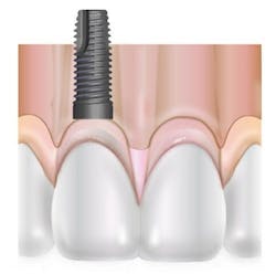 Pennwell web 400 397 Pennwell web 400 397