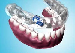 Perioprotect Perioprotect