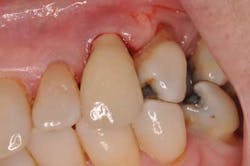 Saliernowrong01 Saliernowrong01