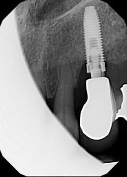 Saliernowrong03 Saliernowrong03