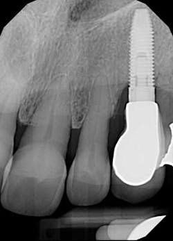 Saliernowrong06 Saliernowrong06