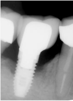 Sawyer Xray 2 Sawyer Xray 2