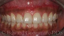 Sept2012gottesman07 Sept2012gottesman07