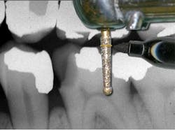 Sept2012kinra03 Sept2012kinra03