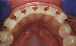 Sept2012miyasaki04 Sept2012miyasaki04