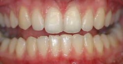 Sept2012miyasaki08 Sept2012miyasaki08