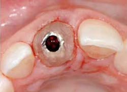 Spearimmedtemp1 Spearimmedtemp1