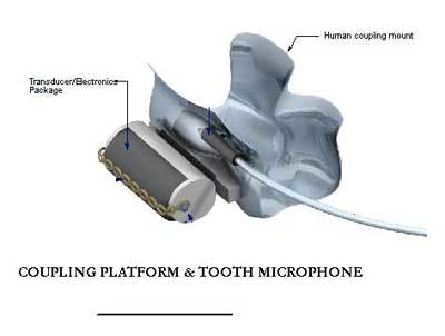 Toothmicrophone