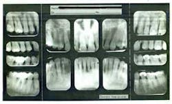 16feb18piafroum Clintip01 16feb18piafroum Clintip01